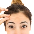 What Does Botox Do to Your Face Over Time?