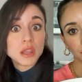 When Will You See the Effects of Botox?