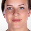 Who is Most Qualified to Administer Botox Injections?