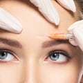 What Does It Feel Like When Botox Sets In?
