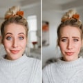 When Does Botox Look the Best?