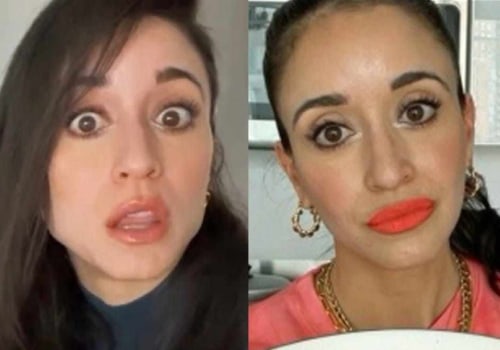 When Will You See the Effects of Botox?