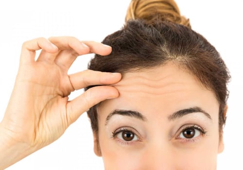 When is the Right Age to Start Getting Botox?