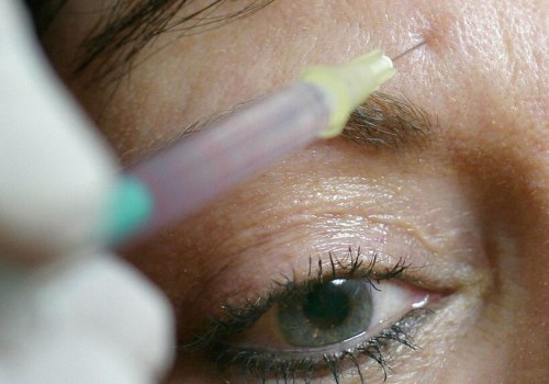Can Botox Cause Nerve Damage?