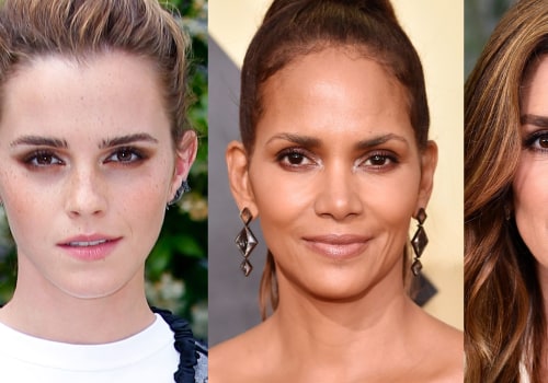 Who gets botox the most?